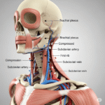 Thoracic Outlet Syndroom (TOS): De complete gids over oorzaken, symptomen en effectieve behandelingen